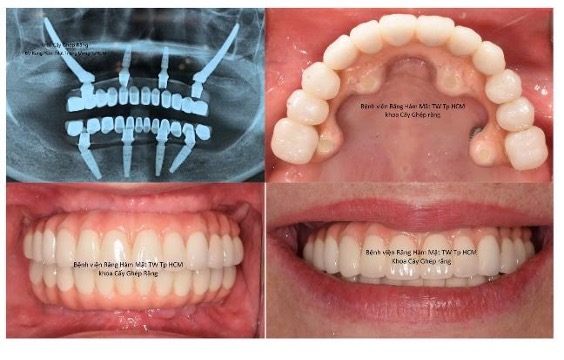 Bệnh viện răng hàm mặt trung ương TPHCM