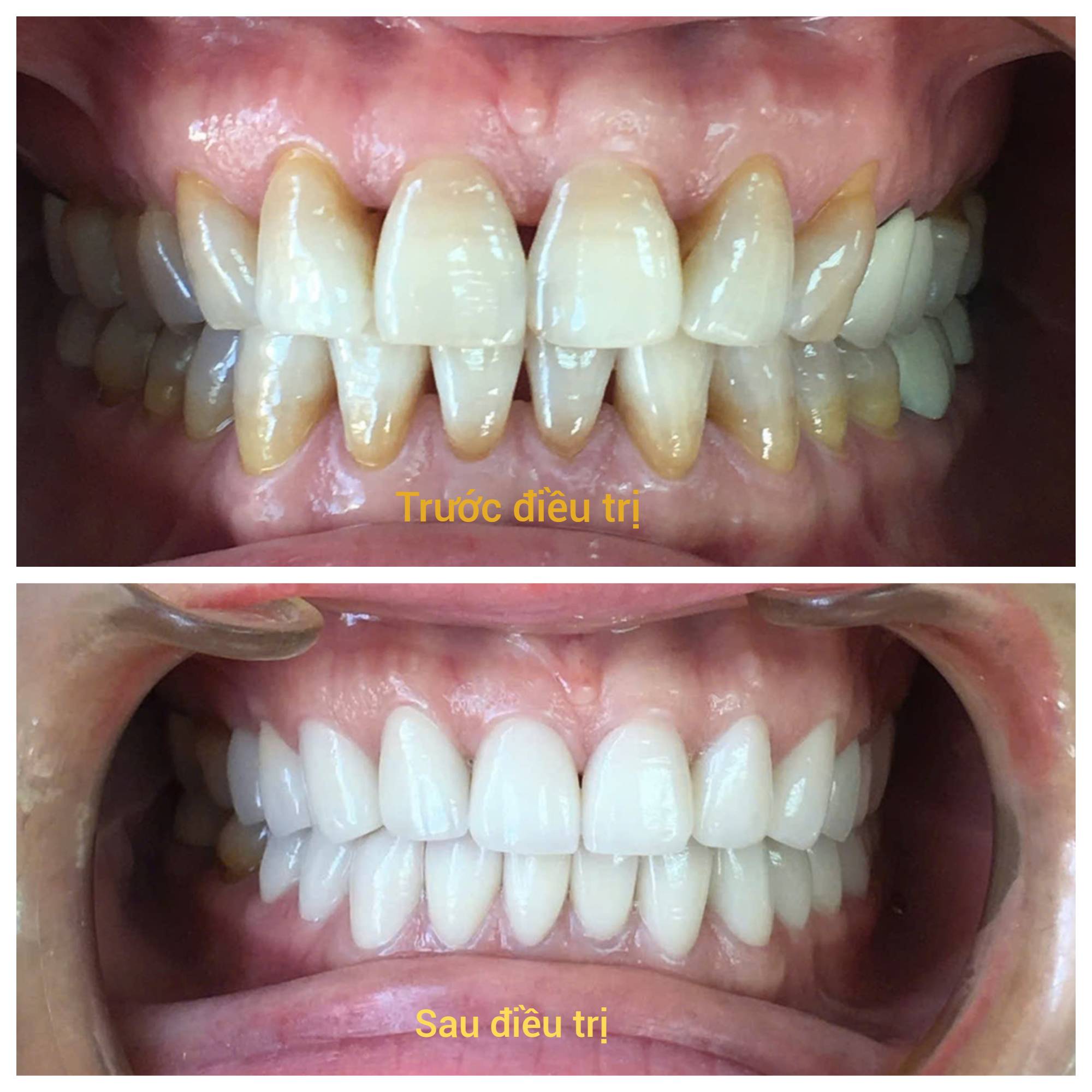 Bệnh viện răng hàm mặt trung ương TPHCM