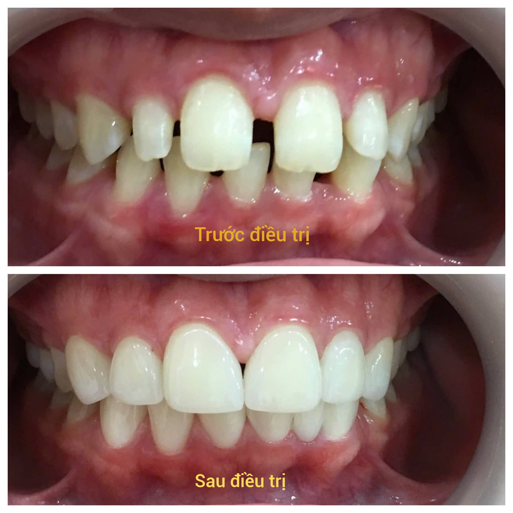 Bệnh viện răng hàm mặt trung ương TPHCM