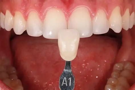 Bệnh viện răng hàm mặt trung ương TPHCM