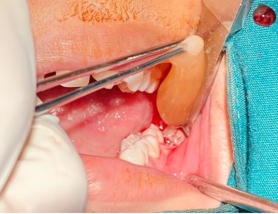 Bệnh viện răng hàm mặt trung ương TPHCM