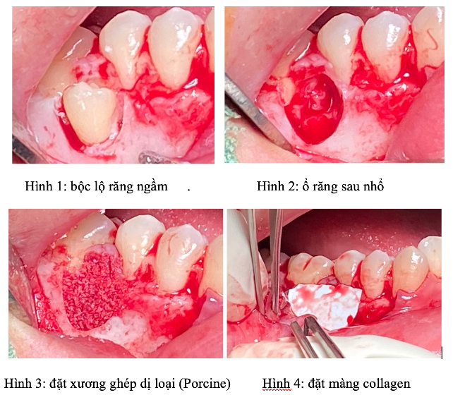 Bệnh viện răng hàm mặt trung ương TPHCM