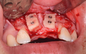 Bệnh viện răng hàm mặt trung ương TPHCM