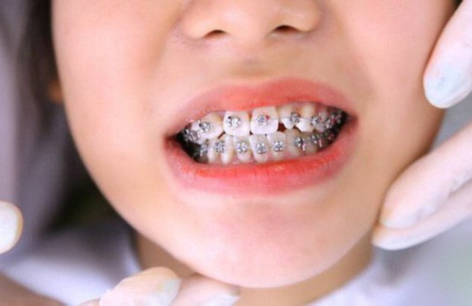 Bệnh viện răng hàm mặt trung ương TPHCM