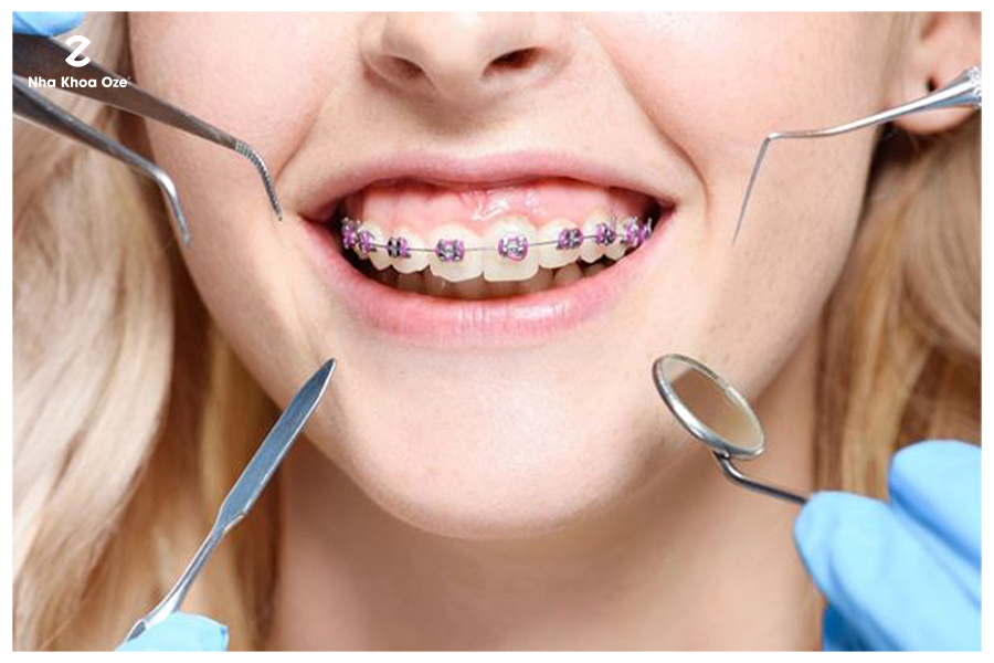 Bệnh viện răng hàm mặt trung ương TPHCM