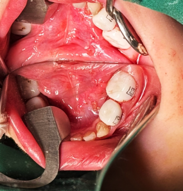 Bệnh viện răng hàm mặt trung ương TPHCM