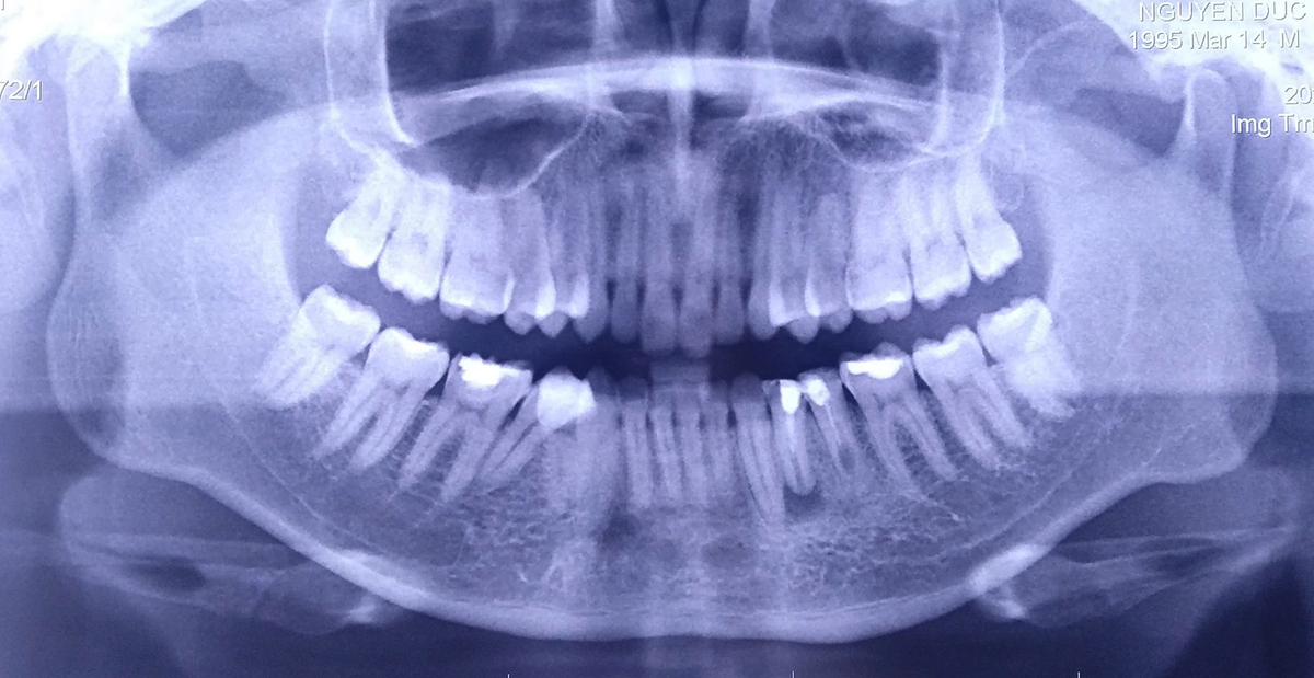 Bệnh viện răng hàm mặt trung ương TPHCM