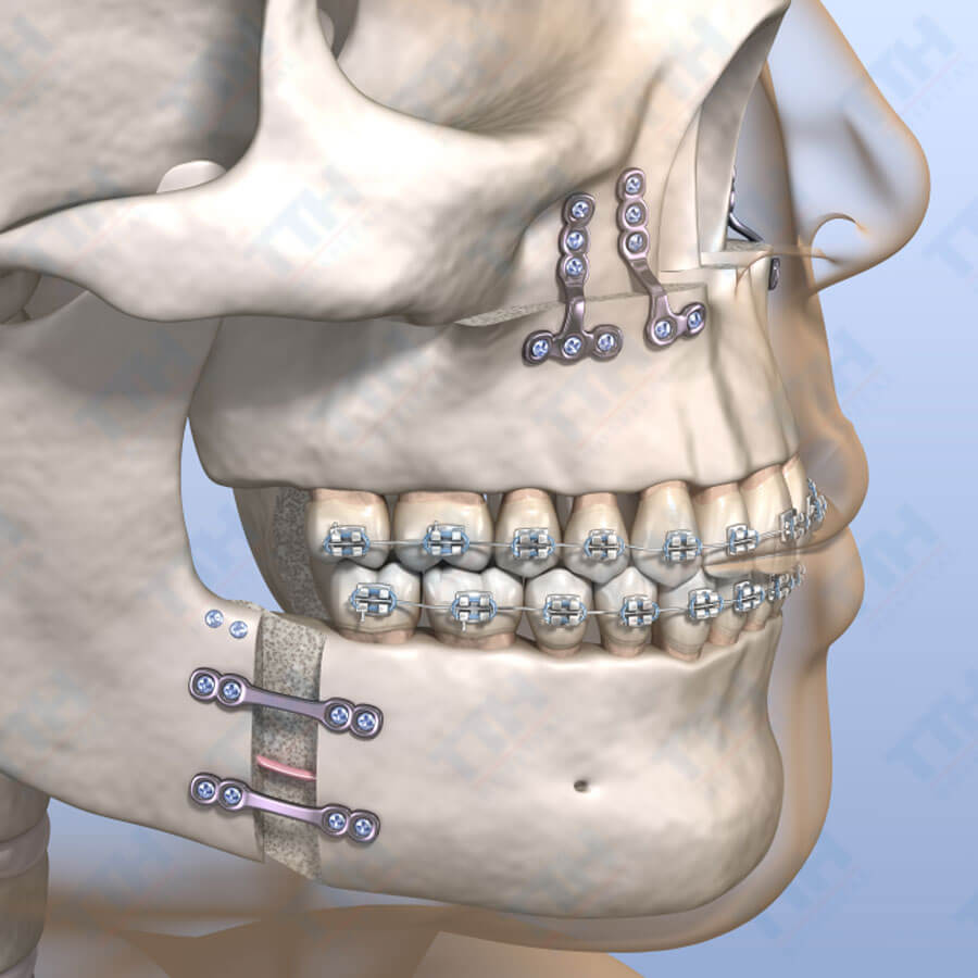Bệnh viện răng hàm mặt trung ương TPHCM