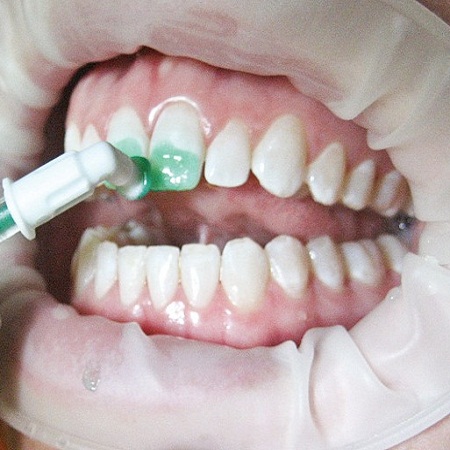 Bệnh viện răng hàm mặt trung ương TPHCM