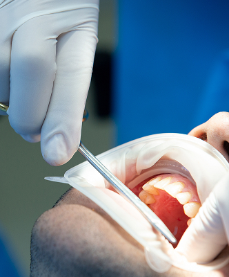 Bệnh viện răng hàm mặt trung ương TPHCM