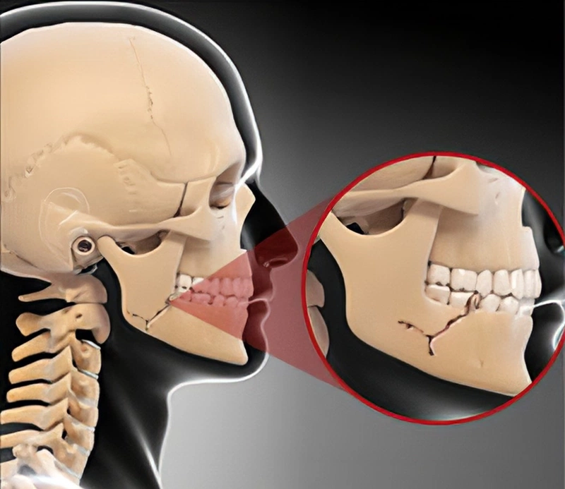 Bệnh viện răng hàm mặt trung ương TPHCM