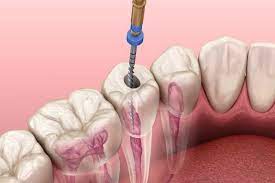 Bệnh viện răng hàm mặt trung ương TPHCM