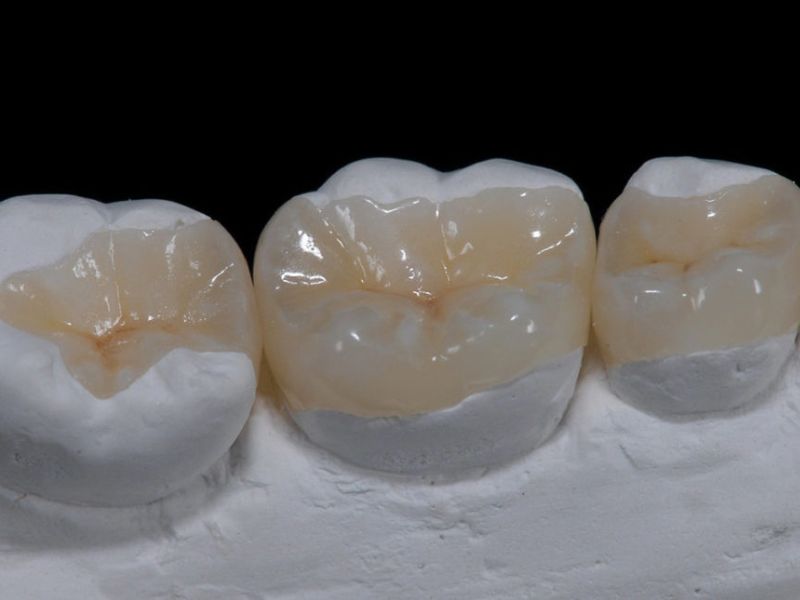 Bệnh viện răng hàm mặt trung ương TPHCM