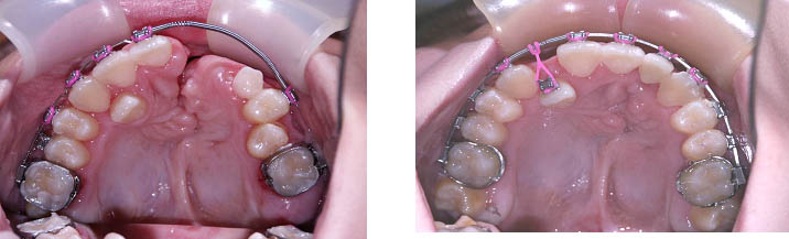 Bệnh viện răng hàm mặt trung ương TPHCM