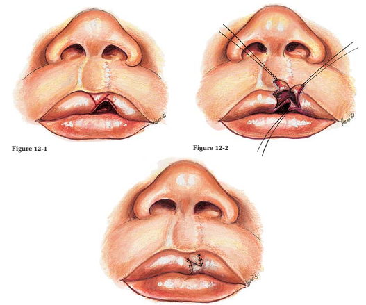 Bệnh viện răng hàm mặt trung ương TPHCM