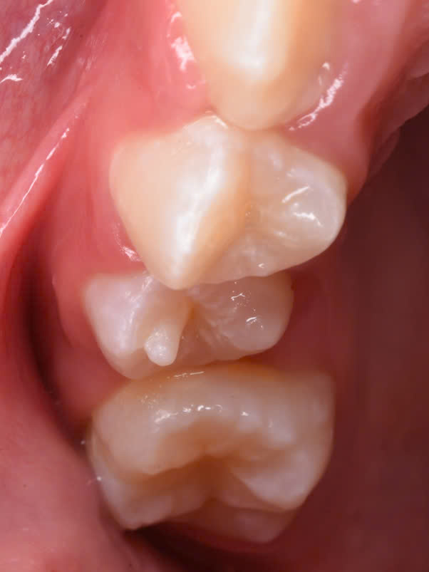 Bệnh viện răng hàm mặt trung ương TPHCM