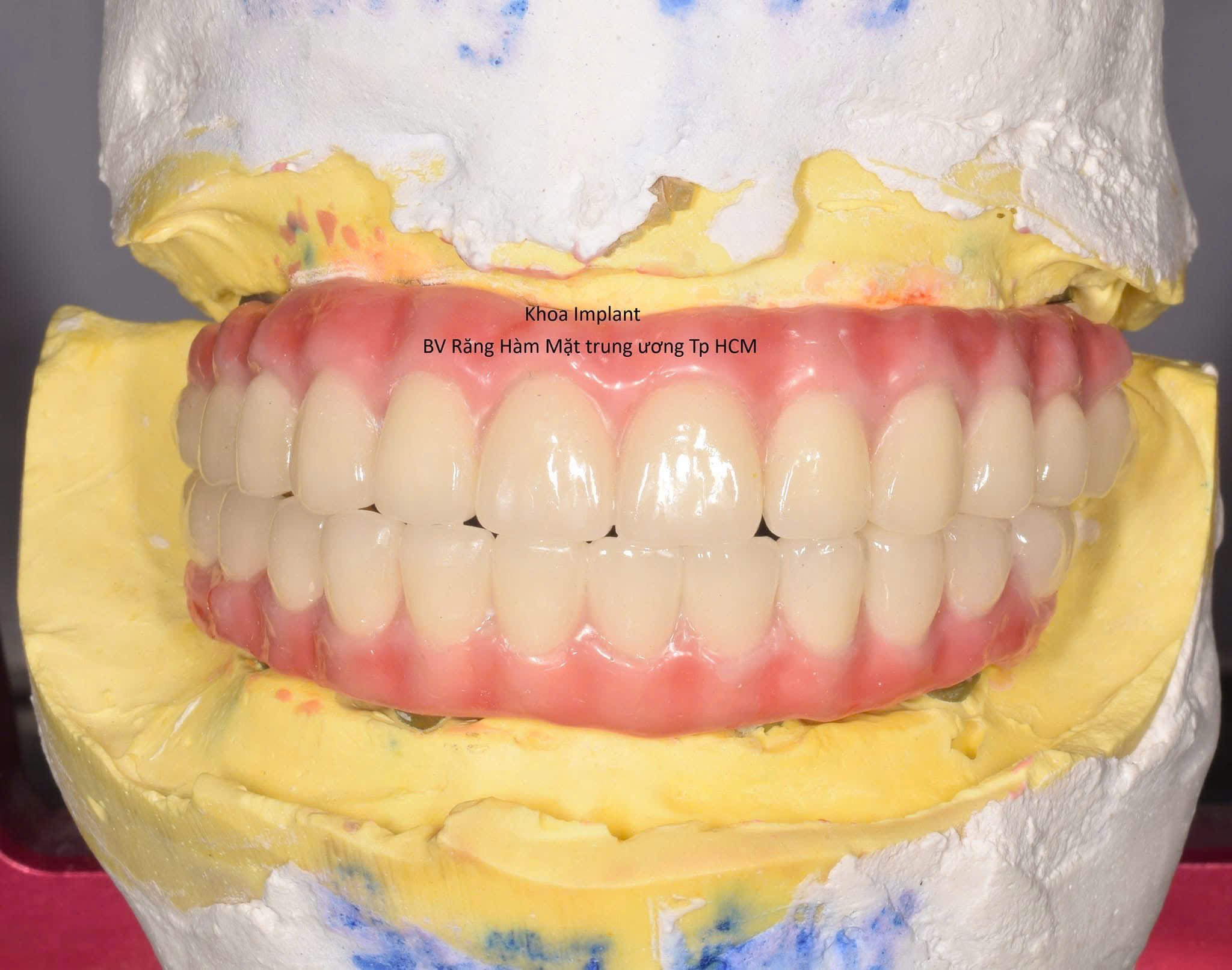 Bệnh viện răng hàm mặt trung ương TPHCM