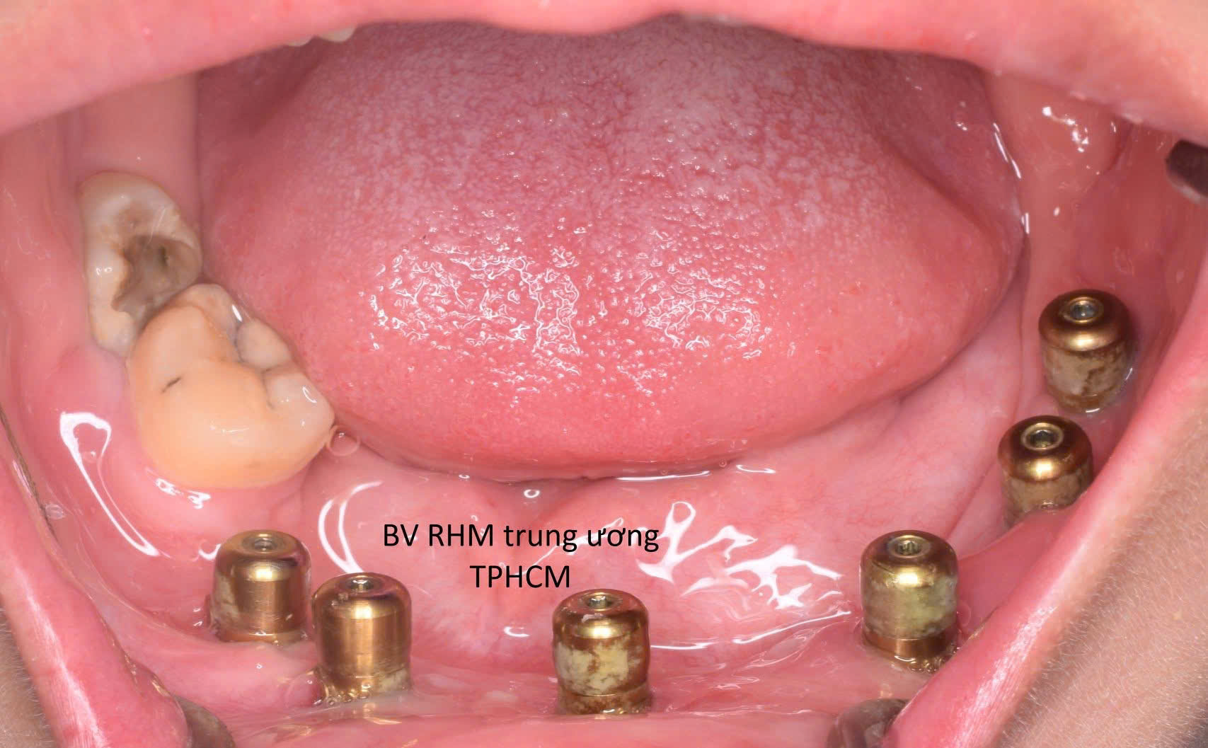 Bệnh viện răng hàm mặt trung ương TPHCM
