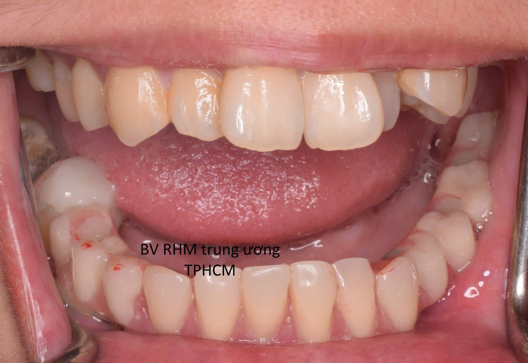 Bệnh viện răng hàm mặt trung ương TPHCM