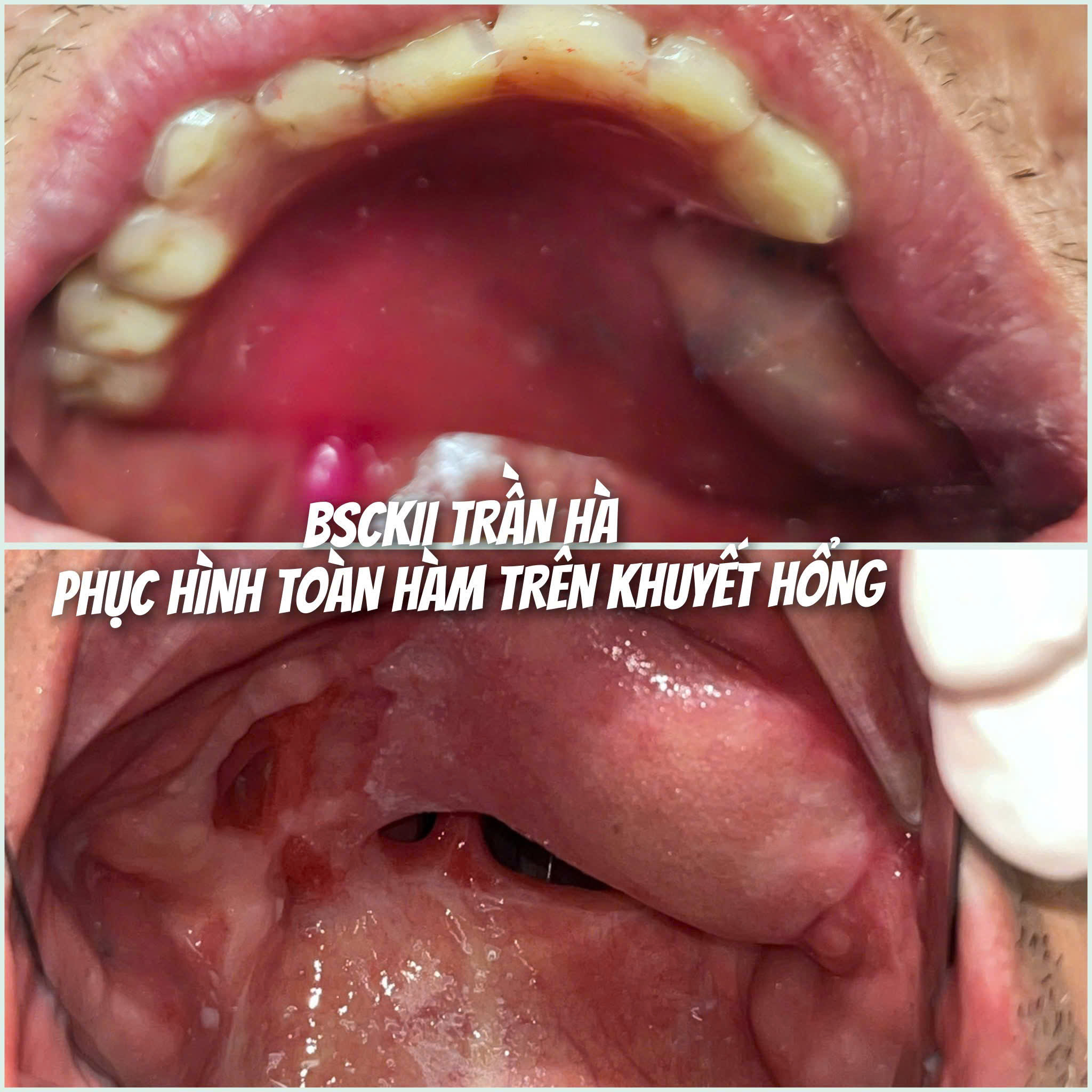 Bệnh viện răng hàm mặt trung ương TPHCM