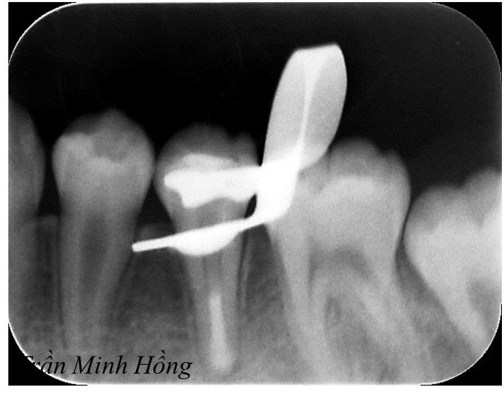 Bệnh viện răng hàm mặt trung ương TPHCM