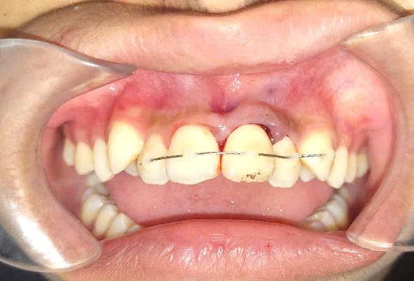 Bệnh viện răng hàm mặt trung ương TPHCM