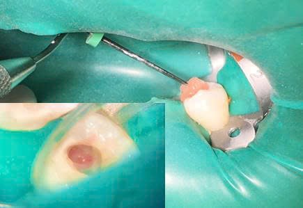 Bệnh viện răng hàm mặt trung ương TPHCM