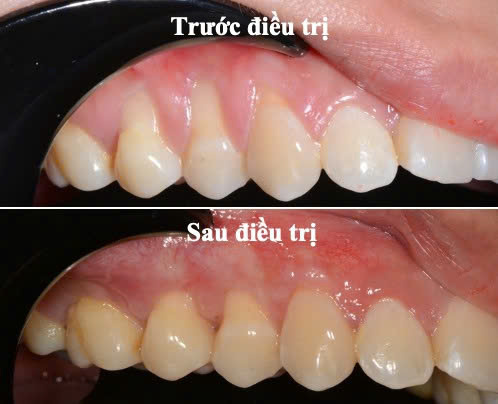 Bệnh viện răng hàm mặt trung ương TPHCM