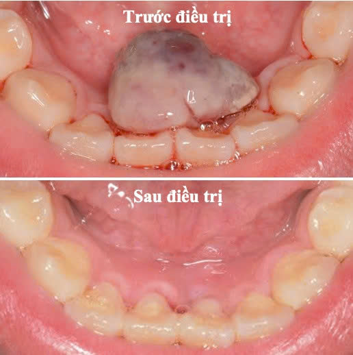 Bệnh viện răng hàm mặt trung ương TPHCM