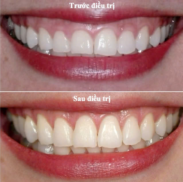 Bệnh viện răng hàm mặt trung ương TPHCM