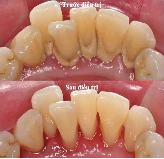 Bệnh viện răng hàm mặt trung ương TPHCM