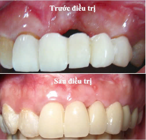 Bệnh viện răng hàm mặt trung ương TPHCM